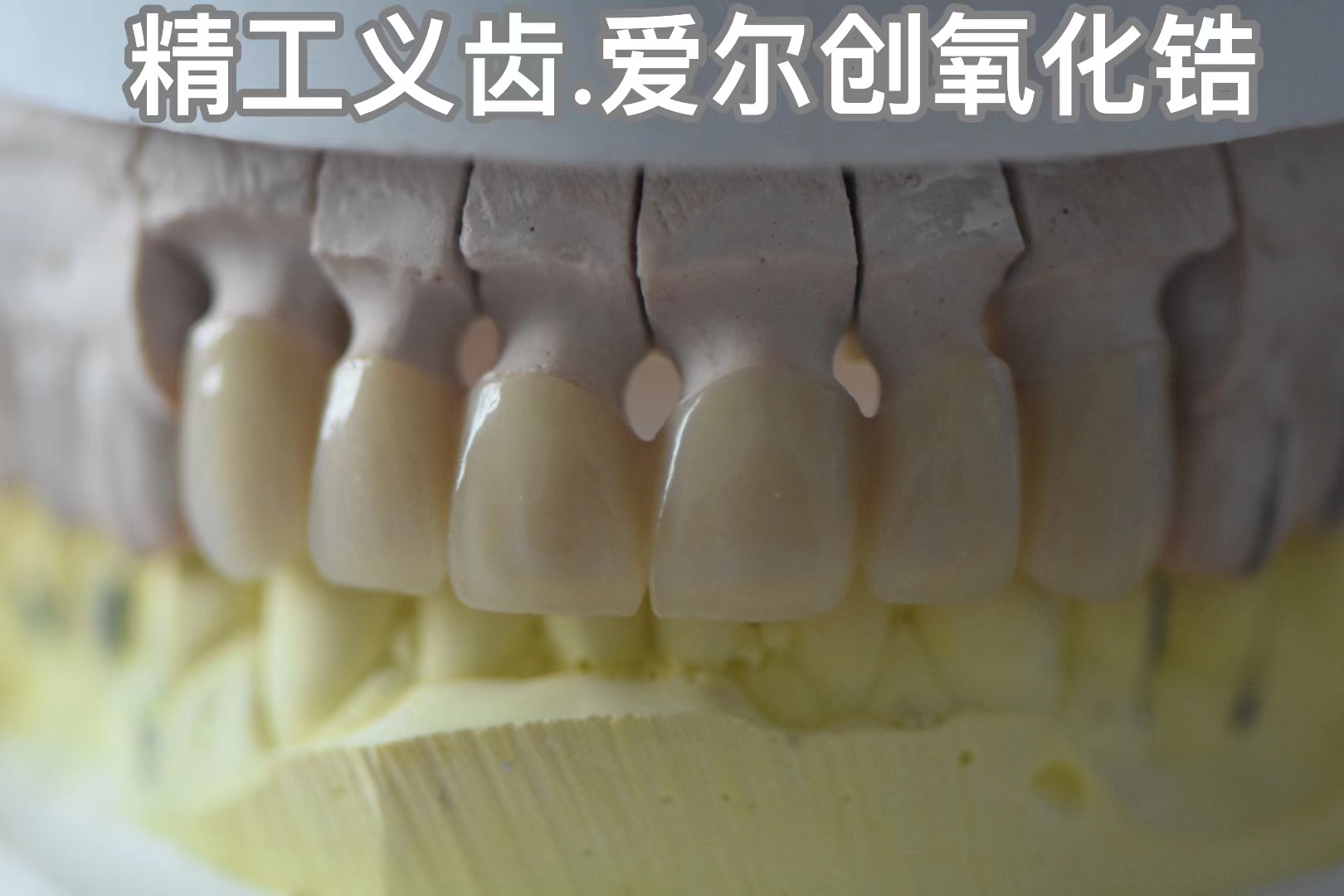 精工義齒.愛爾創氧化鋯